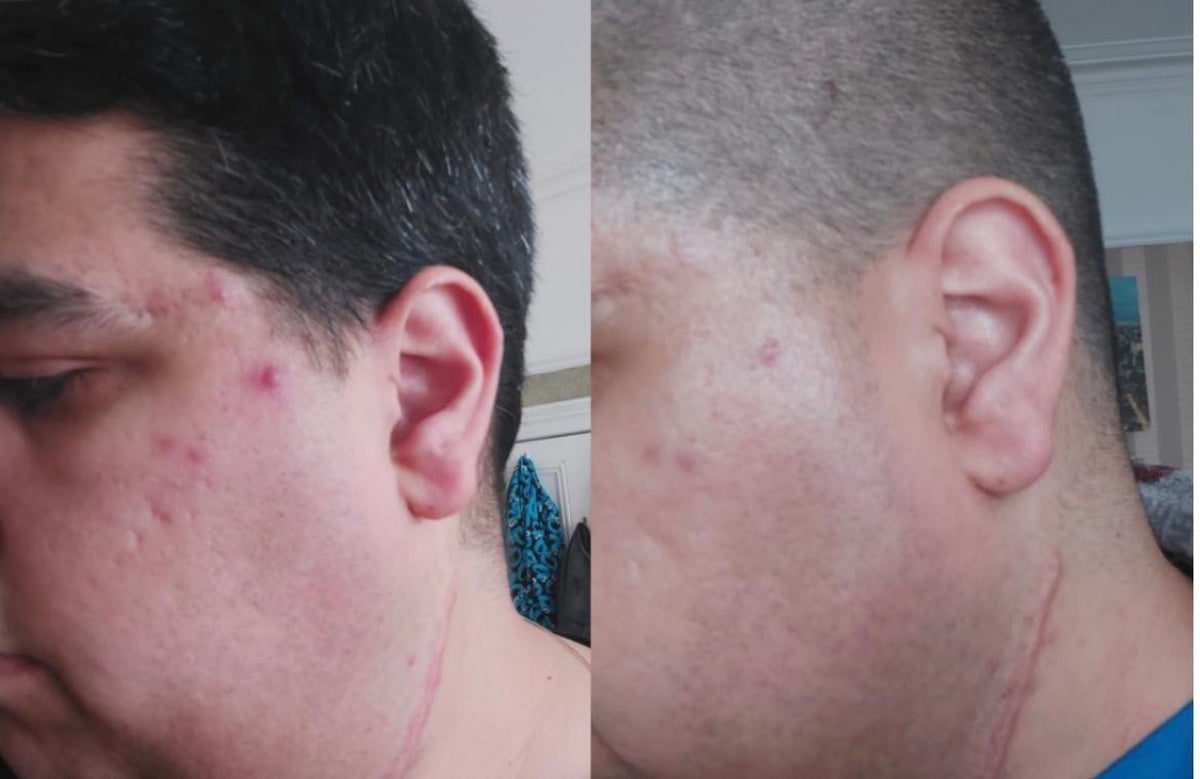 Customer before and after photo