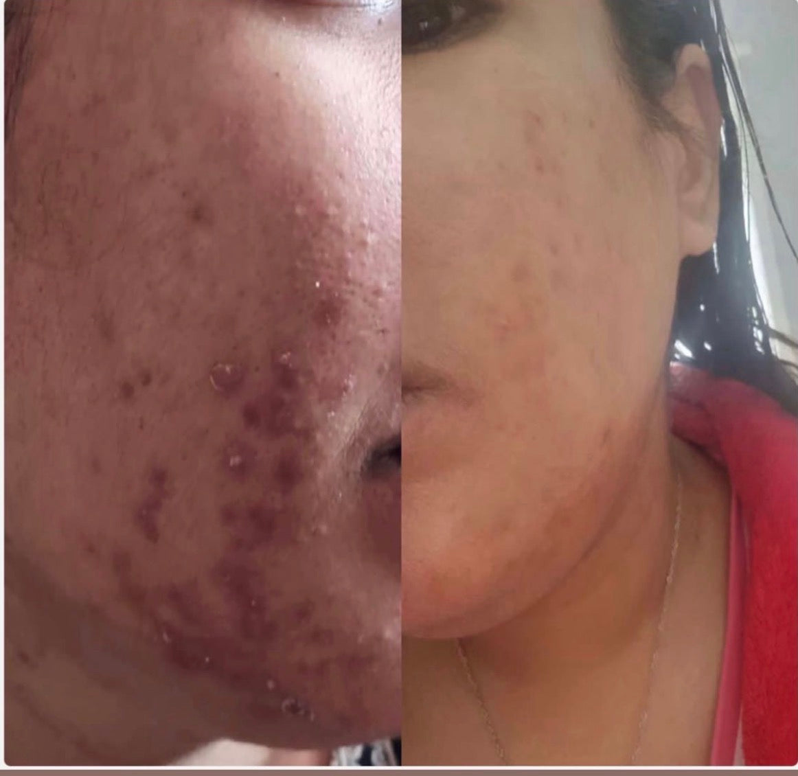 Customer before and after photo