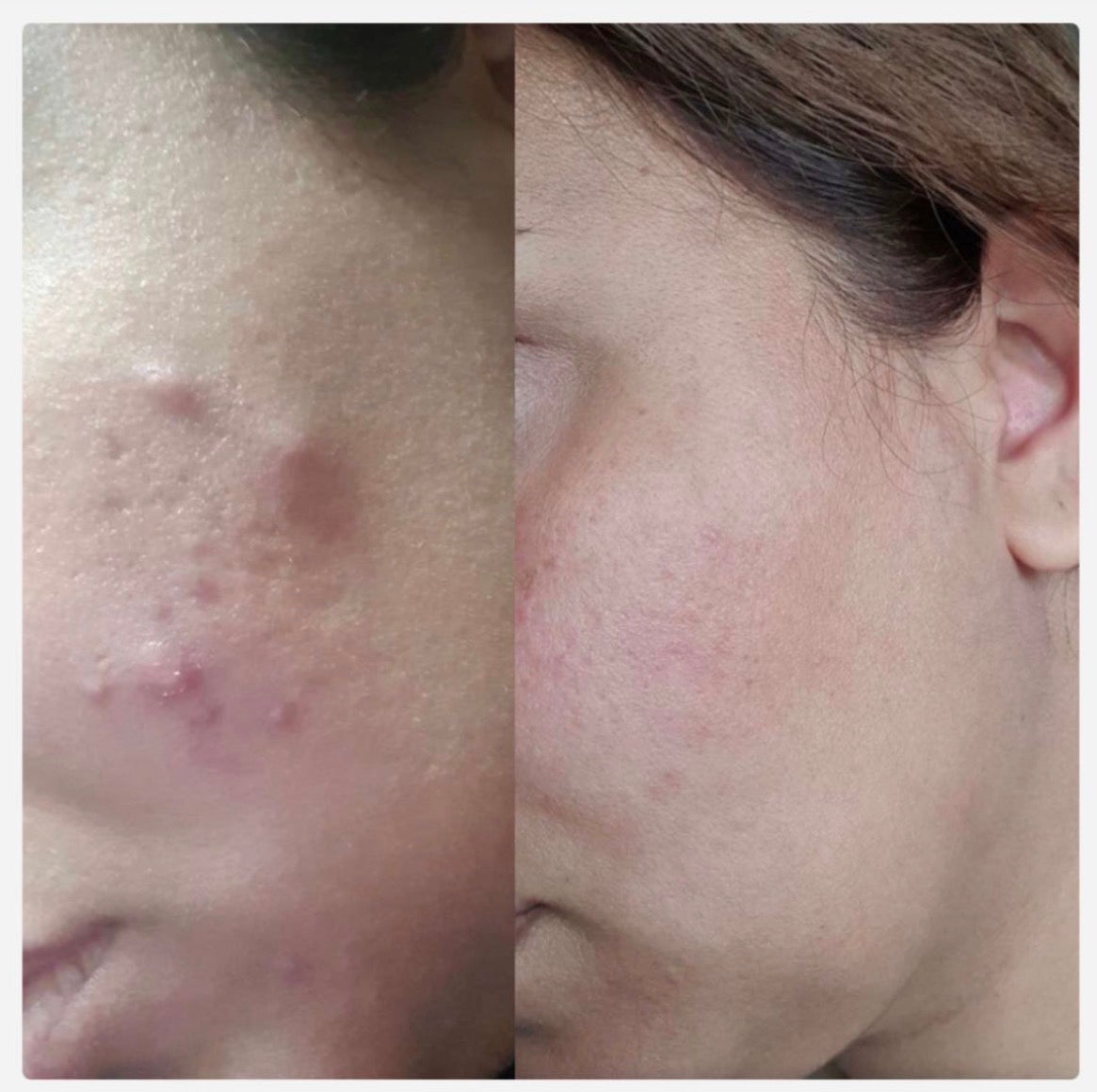 Customer before and after photo