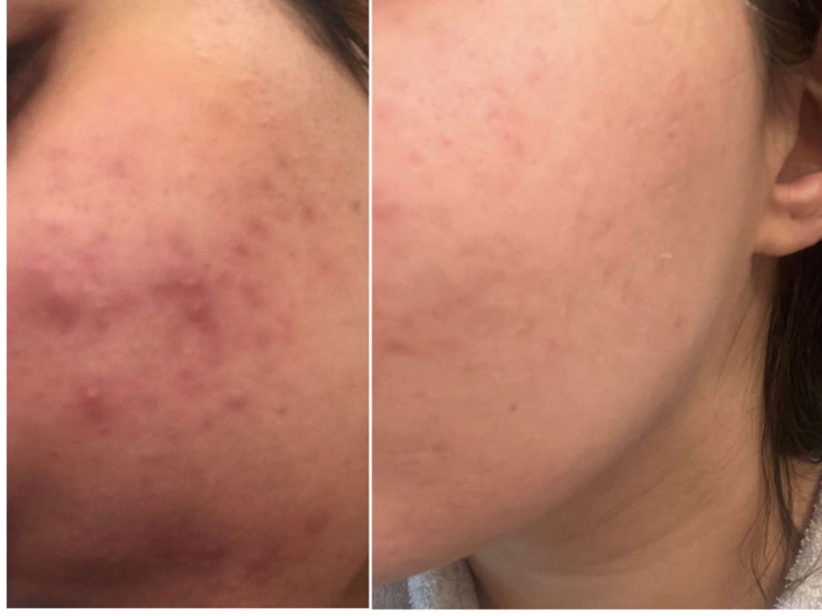 Customer before and after photo