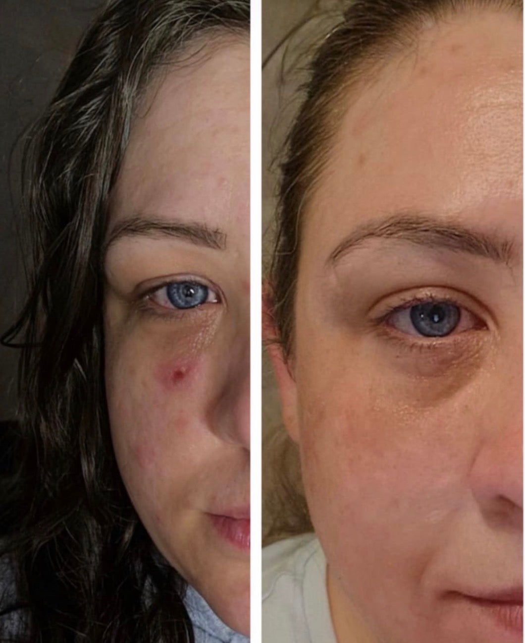 Customer before and after photo
