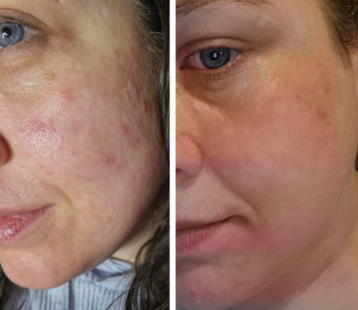 Customer before and after photo